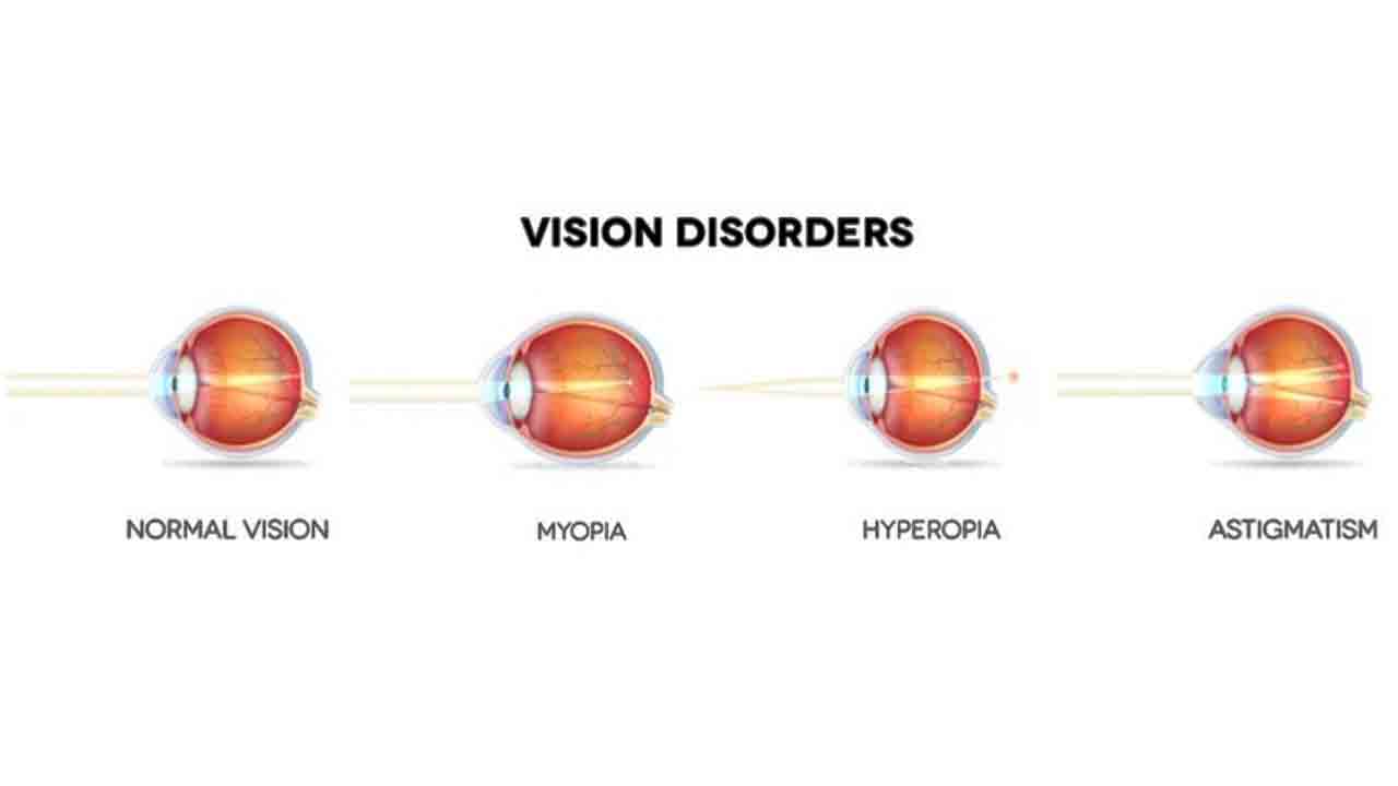 vision disorders can be treated by LASIK